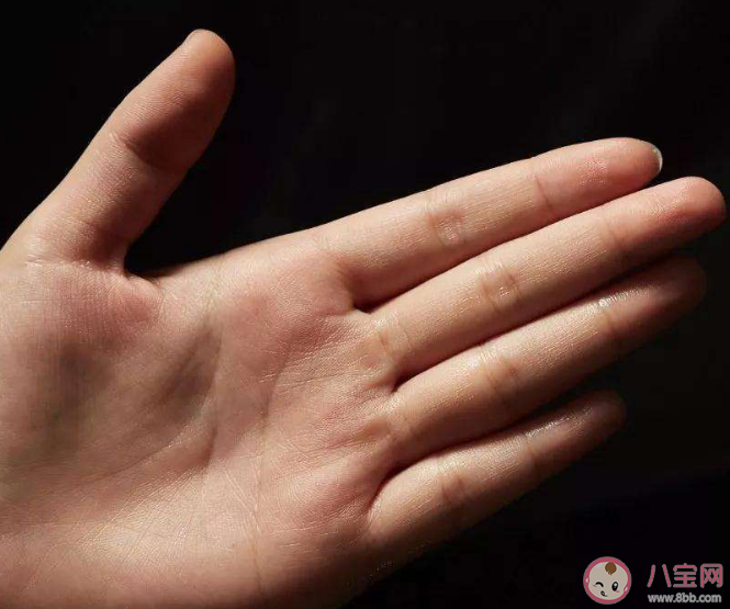 手汗症为什么要去胸外科治疗 手汗症需要手术治疗吗