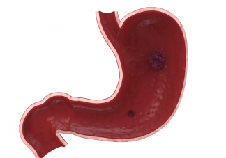 为什么做胃镜还要查梅毒和艾滋病 胃肠镜检查的流程是怎样的