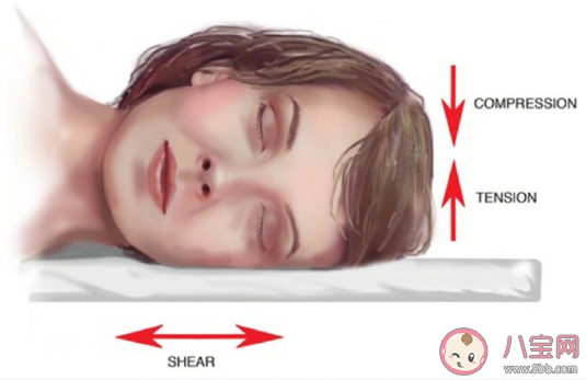 睡觉总是侧卧的人更易长皱纹 皱纹是怎么长出来的