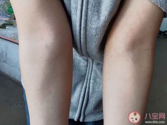 骨头为什么会长刺 远离骨刺要注意什么