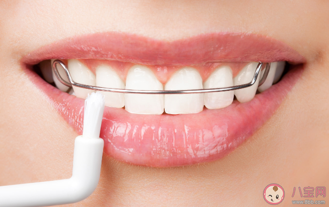 正畸患者如何保持口腔卫生 口腔正畸如何选择时间和方法