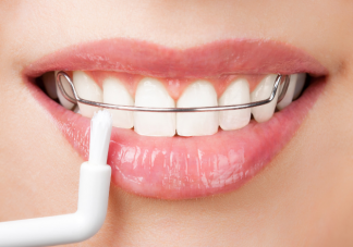正畸患者如何保持口腔卫生 口腔正畸如何选择时间和方法