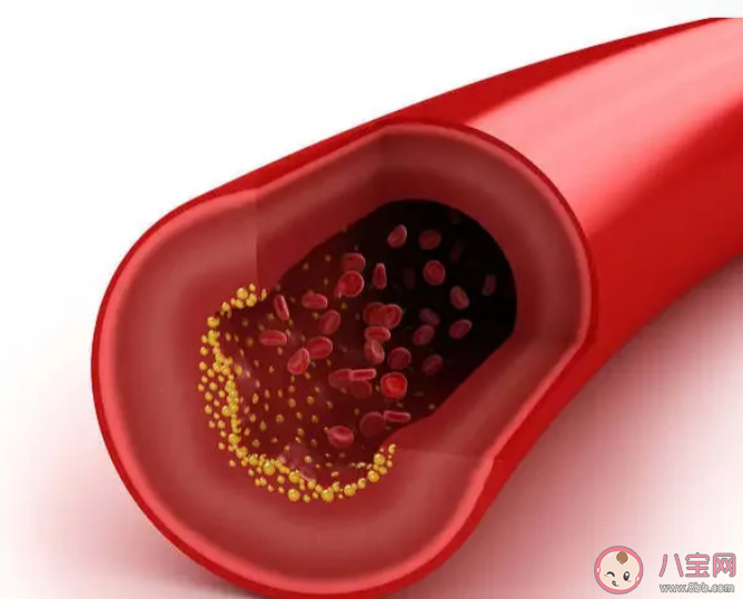 哪些人要监测夜间血压 如何发现夜间高血压