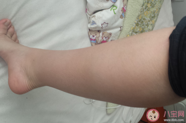 为什么小腿粗一定要练平衡 小腿粗可能是走路姿势错了