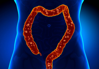 定期查肠镜真的很有必要 哪一种肠息肉容易发生癌变