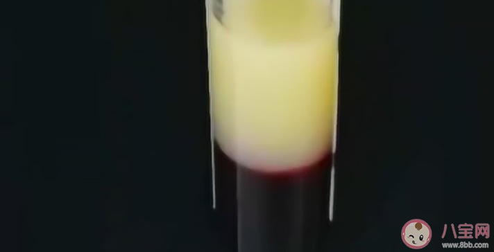 血液为什么会变成白色 哪些人更容易出现牛奶血