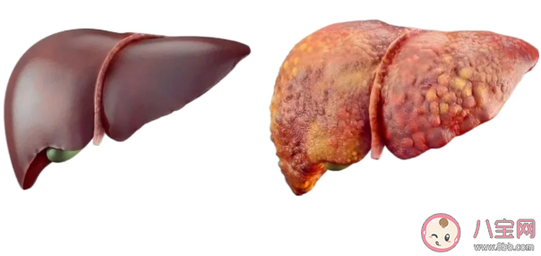 肝功能正常为什么还会得肝癌 肝功能能检查出什么