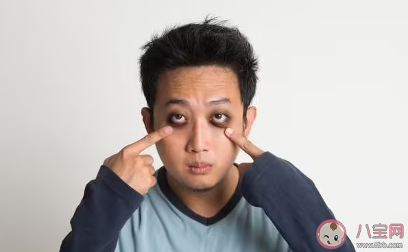 黑眼圈能被睡没吗 黑眼圈怎样才能消除 黑眼圈能被睡没吗 黑眼圈怎样才能消除