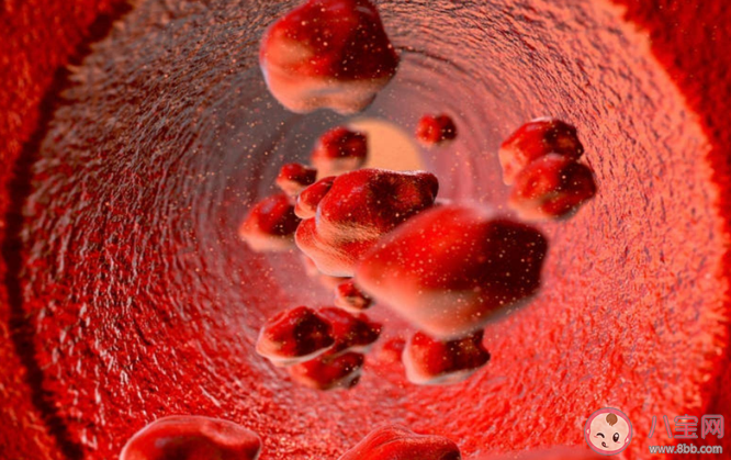 如何预防静脉血栓形成 哪些人是血栓形成的高危人群 如何预防静脉血栓形成 哪些人是血栓形成的高危人群