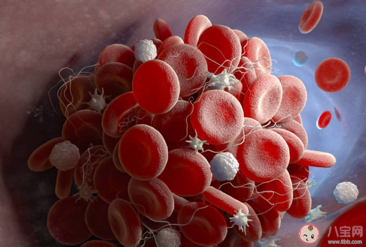 如何预防静脉血栓形成 哪些人是血栓形成的高危人群 如何预防静脉血栓形成 哪些人是血栓形成的高危人群