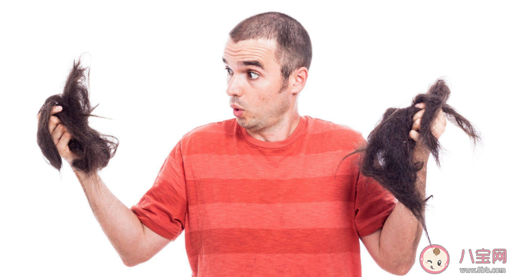年轻人脱发的四大原因 防治脱发的5大误区