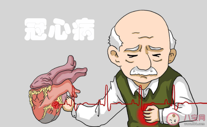 头顶脱发的人冠心病风险高吗 哪些征兆警惕冠心病 头顶脱发的人冠心病风险高吗 哪些征兆警惕冠心病