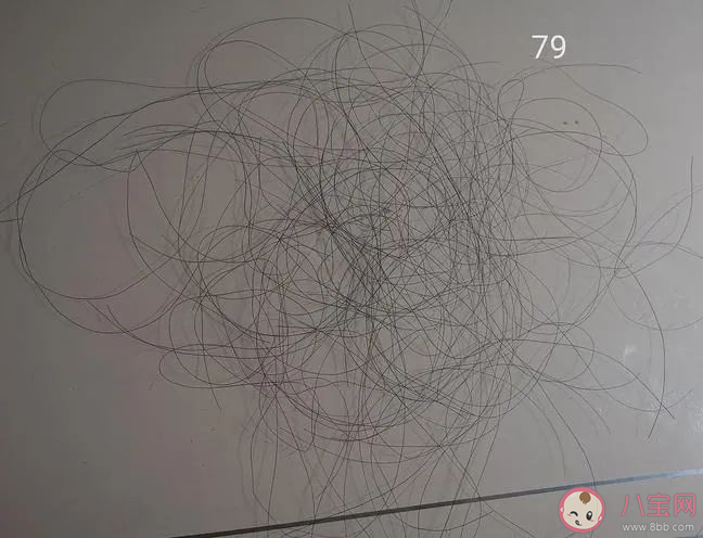 哪个季节是脱发高峰期 脱发了该做哪些检查 哪个季节是脱发高峰期 脱发了该做哪些检查