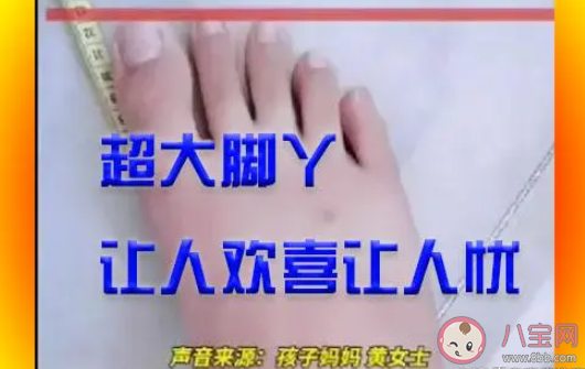 男孩56码大脚丫愁坏老妈 为什么有的人脚大有的人脚小