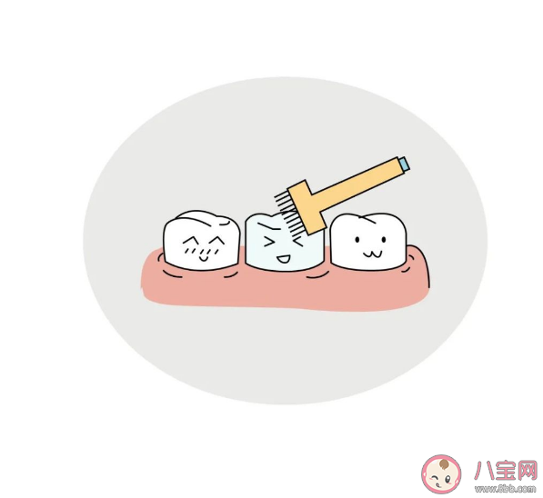 孩子牙齿有色素沉着会影响涂氟吗 什么时候可以做牙齿涂氟