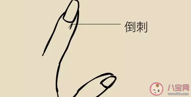 倒刺为什么不能随便拔 手指上为什么会长倒刺 倒刺为什么不能随便拔 手指上为什么会长倒刺