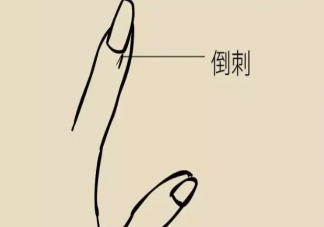 倒刺为什么不能随便拔 手指上为什么会长倒刺