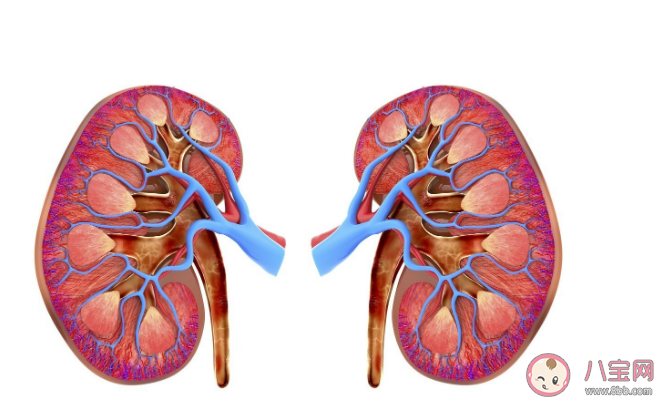 肾结石术后如何护理好 肾结石不及时取出来有什么危害