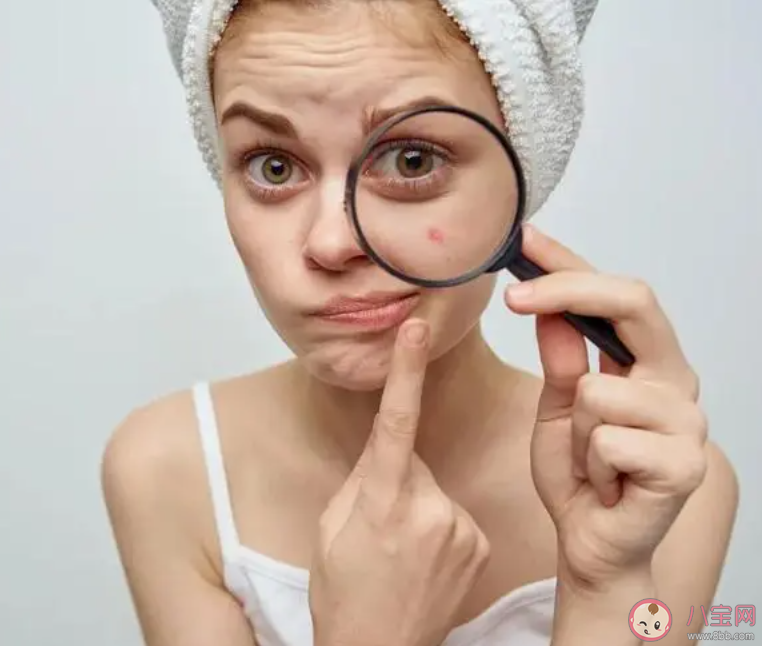 为什么来大姨妈会长痘 姨妈痘喜欢长在哪里 为什么来大姨妈会长痘 姨妈痘喜欢长在哪里