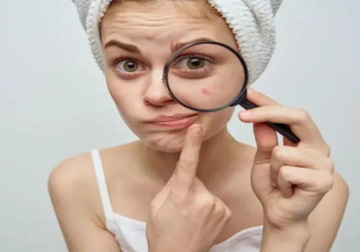 为什么来大姨妈会长痘 姨妈痘喜欢长在哪里