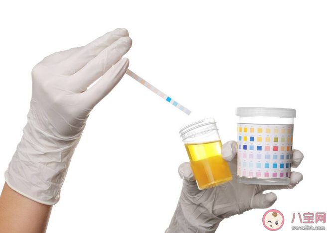 体检时为何要留晨尿 尿检为什么要中段尿 体检时为何要留晨尿 尿检为什么要中段尿