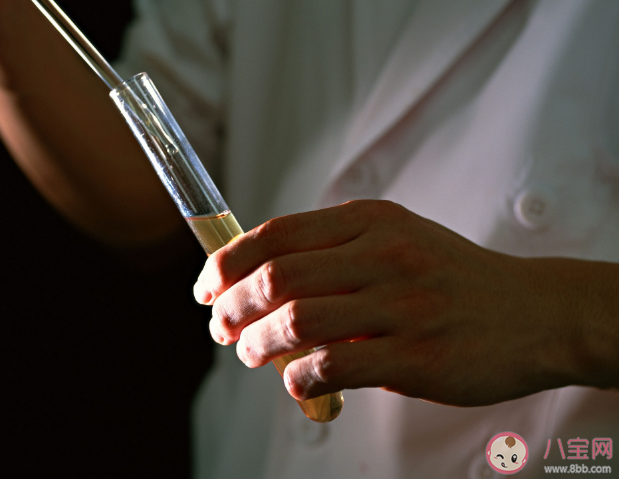 体检时为何要留晨尿 尿检为什么要中段尿 体检时为何要留晨尿 尿检为什么要中段尿