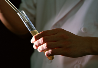 体检时为何要留晨尿 尿检为什么要中段尿