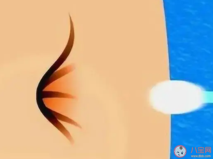 为什么不能抠肚脐眼 肚脐眼脏了之后怎么清洗 为什么不能抠肚脐眼 肚脐眼脏了之后怎么清洗