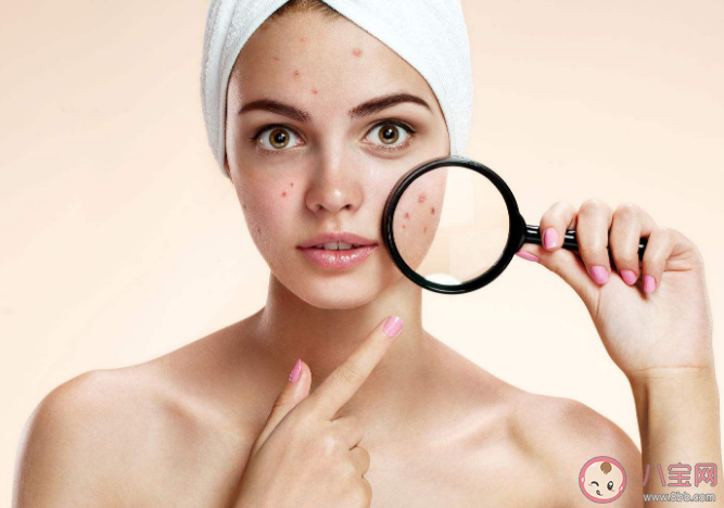 痘痘为什么会氧化变黑 这20个长痘原因你中了吗