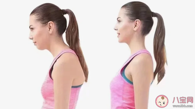 乌龟颈有什么危害 出现乌龟颈怎么办 乌龟颈有什么危害 出现乌龟颈怎么办