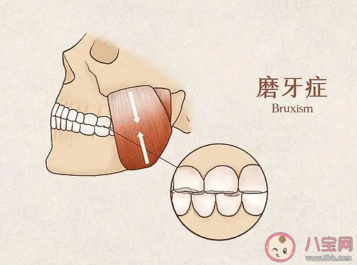 睡觉磨牙的原因有些 磨牙该怎么办