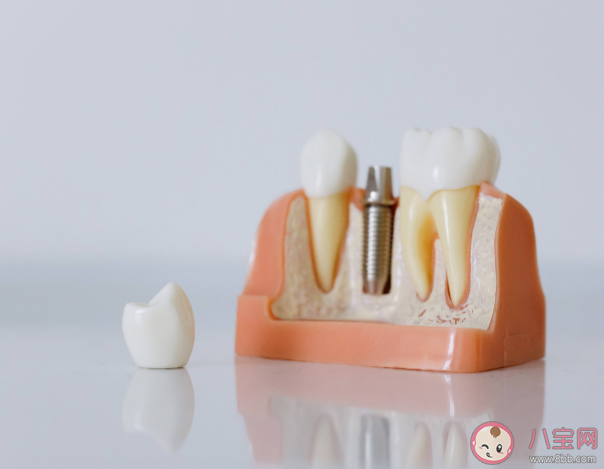 种植牙会干扰影像检查吗 种植牙松动了怎么办 种植牙会干扰影像检查吗 种植牙松动了怎么办