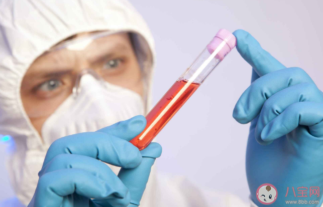 体检中的血粘度测定有必要做吗 抽血检查有什么意义 体检中的血粘度测定有必要做吗 抽血检查有什么意义