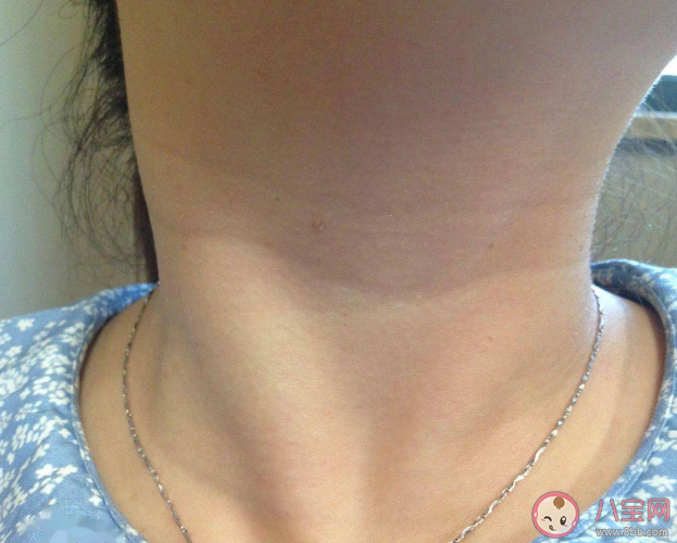 按摩淋巴结能排毒吗 什么情况下淋巴结是异常的