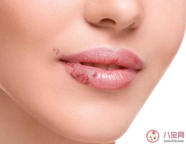 为什么嘴唇特别容易干 嘴唇干涂唇膏没用是怎么回事 为什么嘴唇特别容易干 嘴唇干涂唇膏没用是怎么回事