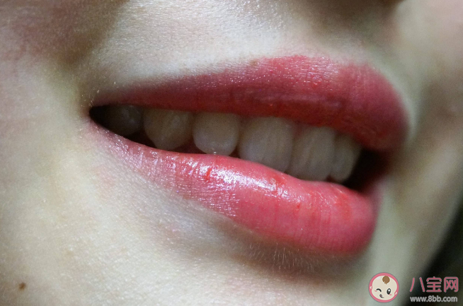 为什么嘴唇特别容易干 嘴唇干涂唇膏没用是怎么回事 为什么嘴唇特别容易干 嘴唇干涂唇膏没用是怎么回事