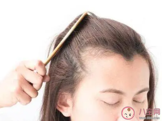 不经意让发际线后移的习惯有哪些 怎样让发际线不继续后移 不经意让发际线后移的习惯有哪些 怎样让发际线不继续后移