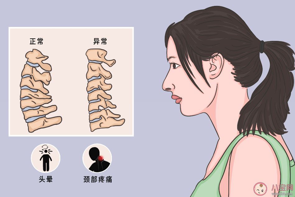 17岁高中生颈椎后凸堪比47岁是怎么回事 颈椎后凸该怎么办 17岁高中生颈椎后凸堪比47岁是怎么回事 颈椎后凸该怎么办