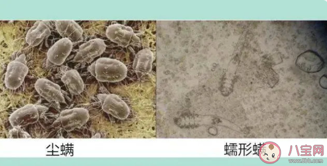 冬季是螨虫的复出期吗 冬季如何消除螨虫