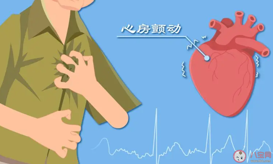 以下哪种生活习惯有助于预防心脑血管疾病 蚂蚁庄园11月18日答案 以下哪种生活习惯有助于预防心脑血管疾病 蚂蚁庄园11月18日答案