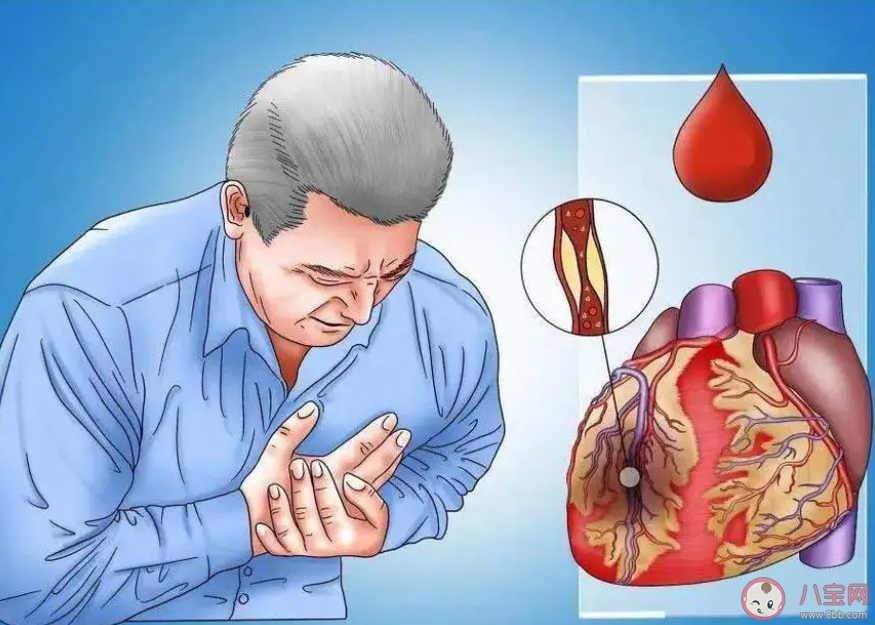 以下哪种生活习惯有助于预防心脑血管疾病 蚂蚁庄园11月18日答案 以下哪种生活习惯有助于预防心脑血管疾病 蚂蚁庄园11月18日答案