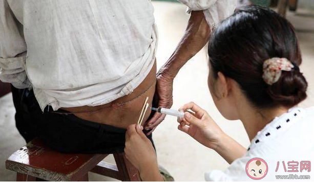 小时候流行的屁股针为什么消失了 为什么打屁股针这么疼