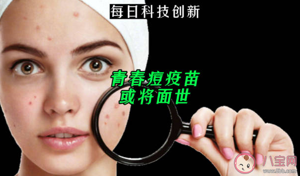 青春痘疫苗或将面世是真的吗 为什么会长青春痘