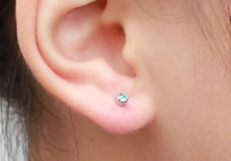 为什么不建议疤痕体质打耳洞 疤痕体质哪些事情不能做