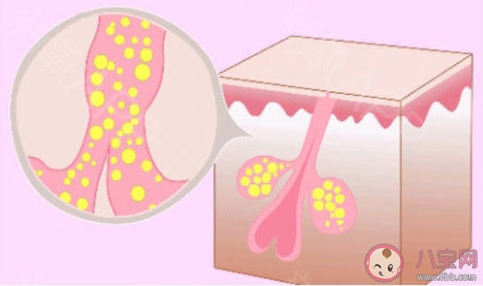 头皮上抠出来的小颗粒到底是啥 经常抠头皮颗粒会秃顶吗